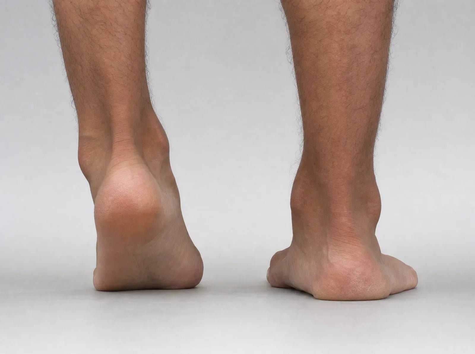 Flat Feet: Is It Really a Problem and What's the Right Solution? - SoftySteps